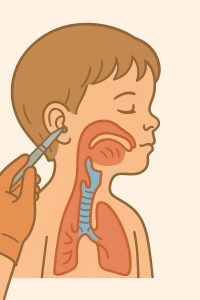 παιδιατρικές επεμβάσεις